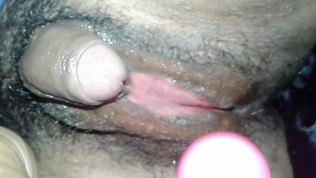 Große klitoris extrem Female Genital